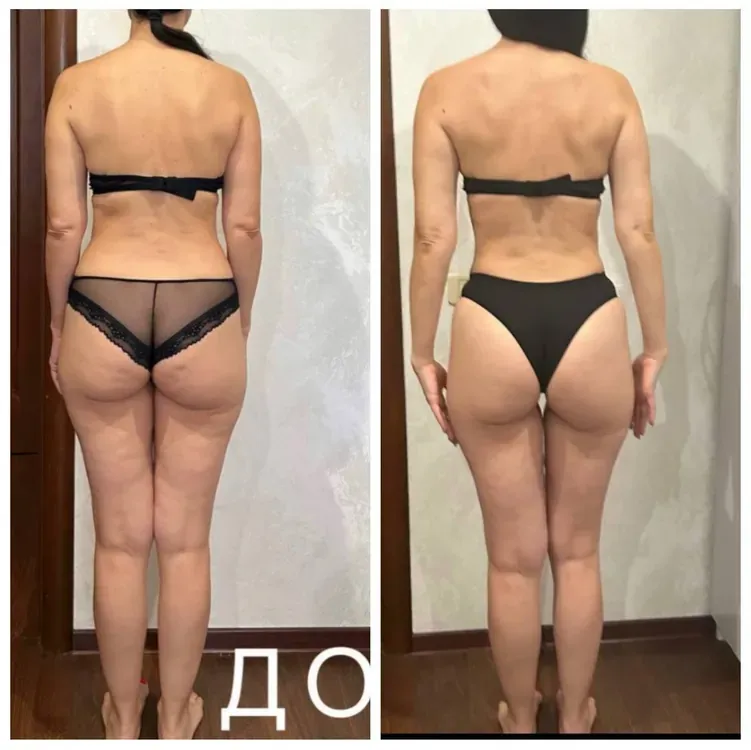 Результат: Ягодицы